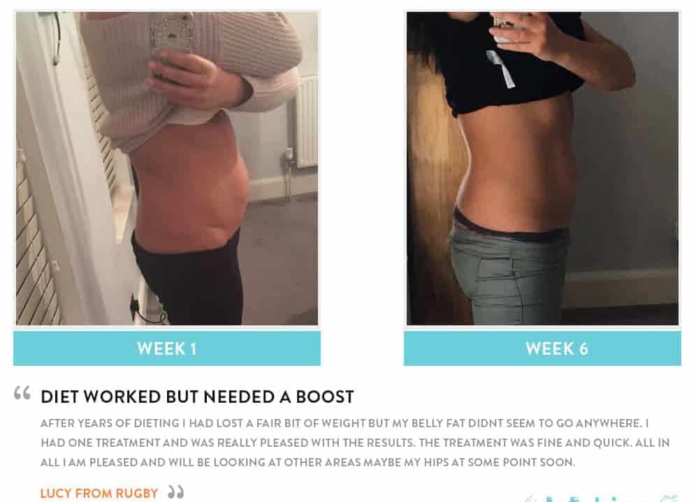 Before and After Dieting Surbiton