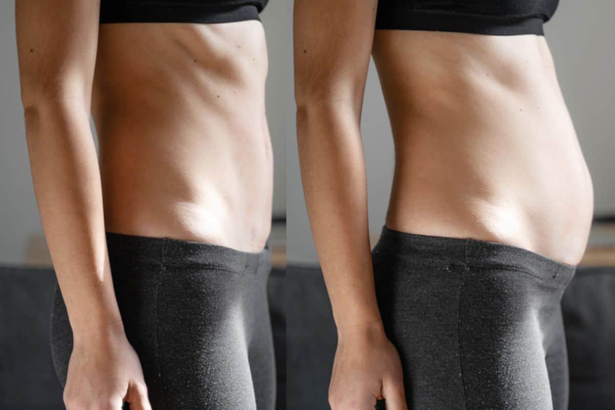 How long does diastasis recti take to improve Surbiton?