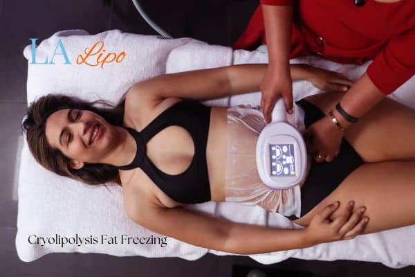 woman getting cryolipolysis Surbiton