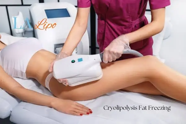 Woman receiving coolsculpting Surbiton treatment on her thighs