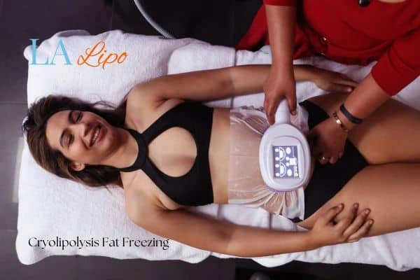 woman getting cryolipolysis Surbiton
