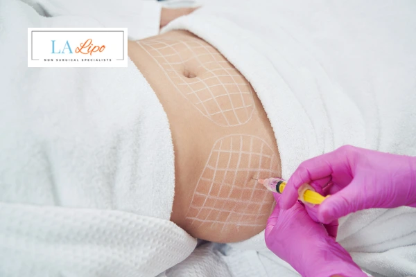 aqualyx fat dissolving injections Surbiton