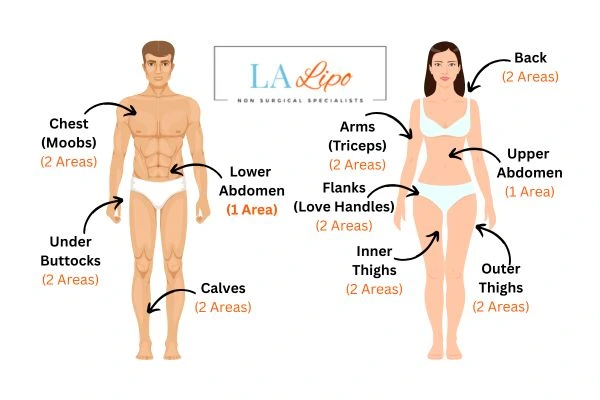 LA LIPO Cryolipolysis Areas Surbiton