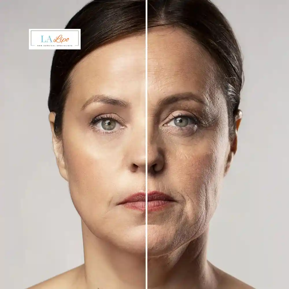 How Can You Tell If Non-Surgical Skin Tightening Is Right for You Surbiton?