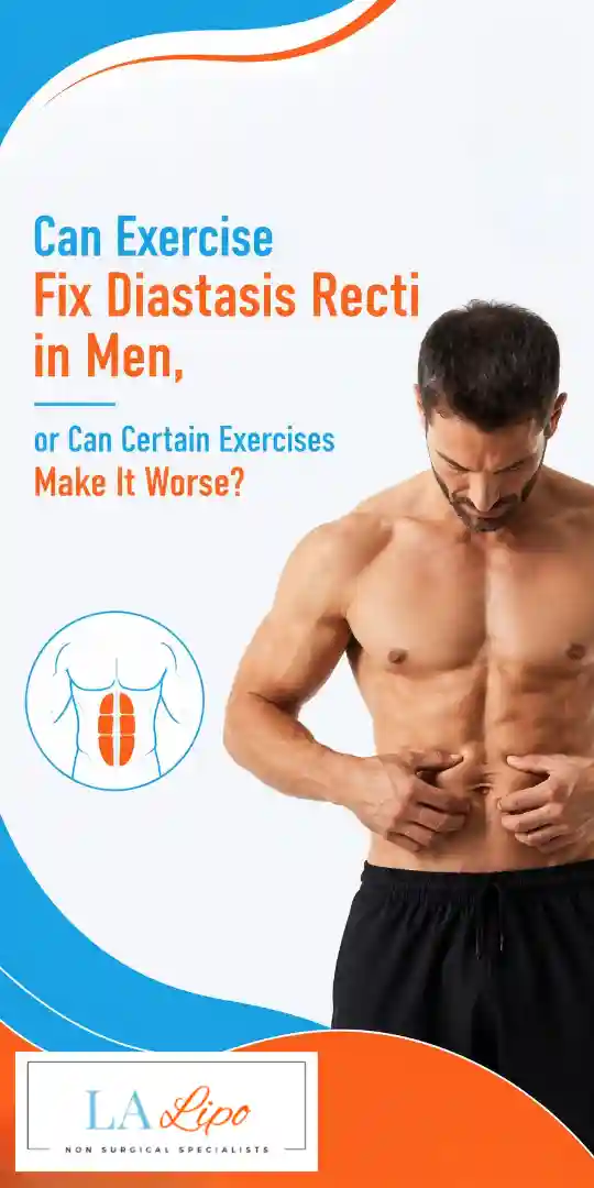 Can Exercise Fix Diastasis Recti in Men, or Can Certain Exercises Make It Worse Surbiton?
