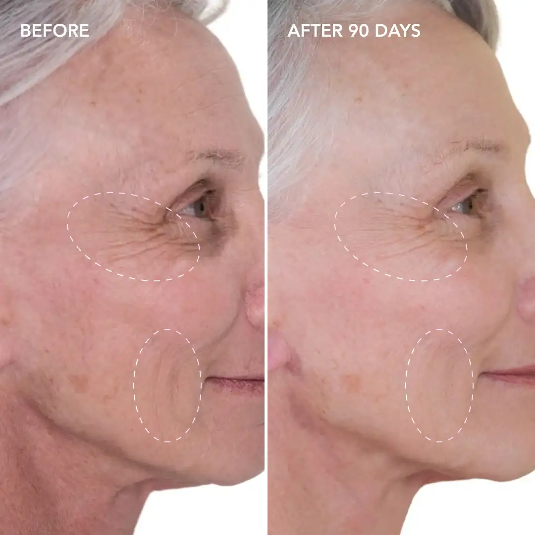 When will you see results Surbiton